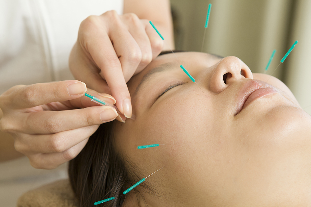 Acupuncturist to refer to acupuncture to face